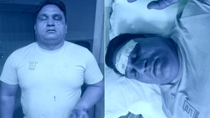 दिल्ली में दुस्साहस: शिव नगर में बदमाशों ने पुलिस टीम पर किया चाकू से हमला; लहूलुहान होकर भी जवानों ने दो को दबोचा