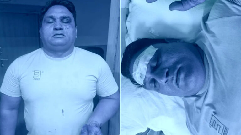 दिल्ली में दुस्साहस: शिव नगर में बदमाशों ने पुलिस टीम पर किया चाकू से हमला; लहूलुहान होकर भी जवानों ने दो को दबोचा
